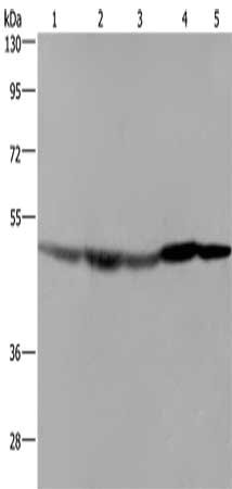 Gel: 8%SDS-PAGE, Lysate: 40 ug, Lane 1-5: Hela cells, mouse liver tissue, Mouse brain tissue, Mouse heart tissue, RAW264.7 cells, Primary antibody: CSB-PA045962(FH Antibody) at dilution 1/600, Secondary antibody: Goat anti rabbit IgG at 1/8000 dilution, Exposure time: 20 seconds