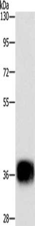 Gel: 10%SDS-PAGE, Lysate: 40 ug, Lane: Mouse heart tissue, Primary antibody: CSB-PA046028(CEBPE Antibody) at dilution 1/500, Secondary antibody: Goat anti rabbit IgG at 1/8000 dilution, Exposure time: 5 seconds Gel: 10%SDS-PAGE, Lysate: 40 ug, Lane: Mouse heart tissue, Primary antibody: CSB-PA046028(CEBPE Antibody) at dilution 1/500, Secondary antibody: Goat anti rabbit IgG at 1/8000 dilution, Exposure time: 5 seconds