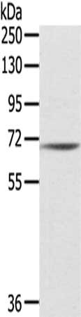 Western Blotting(WB) - IL18R1 Antibody