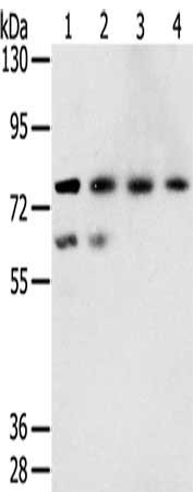 Gel: 6%SDS-PAGE, Lysate: 40 ug, Lane 1-4: A549 cells, hepg2 cells, lovo cells, A431 cells, Primary antibody: CSB-PA057341(TMPRSS7 Antibody) at dilution 1/250, Secondary antibody: Goat anti rabbit IgG at 1/8000 dilution, Exposure time: 5 minutes