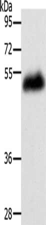 Gel: 10%SDS-PAGE, Lysate: 60 ug, Lane: Human leiomyosarcoma tissue, Primary antibody: CSB-PA061510(LOX Antibody) at dilution 1/400, Secondary antibody: Goat anti rabbit IgG at 1/8000 dilution, Exposure time: 20 seconds