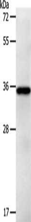 Gel: 10%SDS-PAGE, Lysate: 40 ug, Lane: Jurkat cells, Primary antibody: CSB-PA066483(LPPR5 Antibody) at dilution 1/1200, Secondary antibody: Goat anti rabbit IgG at 1/8000 dilution, Exposure time: 30 seconds