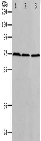 Gel: 10%SDS-PAGE, Lysate: 40 ug, Lane 1-3: K562 cells, hela cells, 293T cells, Primary antibody: CSB-PA077190(PRMT5 Antibody) at dilution 1/400, Secondary antibody: Goat anti rabbit IgG at 1/8000 dilution, Exposure time: 2 minutes