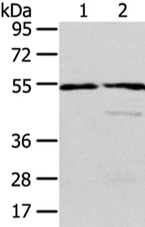 Gel: 6%SDS-PAGE, Lysate: 40 ug, Lane 1-2: Human normal liver and fetal liver tissue, Primary antibody: CSB-PA090286(ALDH3A2 Antibody) at dilution 1/250 dilution, Secondary antibody: Goat anti rabbit IgG at 1/8000 dilution, Exposure time: 10 seconds