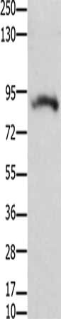 Gel: 8%SDS-PAGE, Lysate: 30 ug, Lane: Mouse brain tissue, Primary antibody: CSB-PA100870(KCNH2 Antibody) at dilution 1/100, Secondary antibody: Goat anti rabbit IgG at 1/8000 dilution, Exposure time: 5 minutes