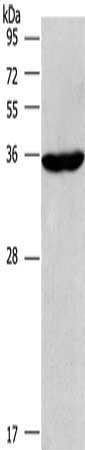 Gel: 6%SDS-PAGE, Lysate: 40 ug, Lane: Raji cells, Primary antibody: CSB-PA102580(CIAPIN1 Antibody) at dilution 1/597, Secondary antibody: Goat anti rabbit IgG at 1/8000 dilution, Exposure time: 2 minutes
