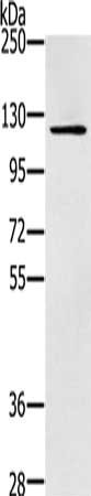 Gel: 6%SDS-PAGE, Lysate: 40 ug, Lane: Skov3 cells, Primary antibody: CSB-PA103365(ZMIZ1 Antibody) at dilution 1/200, Secondary antibody: Goat anti rabbit IgG at 1/8000 dilution, Exposure time: 2 minutes