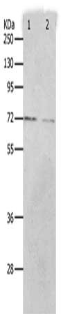 Gel: 10%SDS-PAGE, Lysate: 40 ug, Lane 1-3: K562 cells, hela cells, 293T cells, Primary antibody: CSB-PA107290(PRMT5 Antibody) at dilution 1/300, Secondary antibody: Goat anti rabbit IgG at 1/8000 dilution, Exposure time: 10 minutes