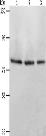 Gel: 8%SDS-PAGE, Lysate: 40 ug, Lane 1-3: Mouse stomach tissue, Mouse liver tissue, Mouse kidney tissue, Primary antibody: CSB-PA110823(ACOX1 Antibody) at dilution 1/350, Secondary antibody: Goat anti rabbit IgG at 1/8000 dilution, Exposure time: 1 minute
