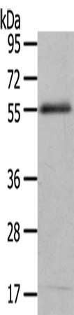 Gel: 10%SDS-PAGE, Lysate: 30 ug, Lane: 293T cells, Primary antibody: CSB-PA117174(ENPP7 Antibody) at dilution 1/700, Secondary antibody: Goat anti rabbit IgG at 1/8000 dilution, Exposure time: 1 minute
