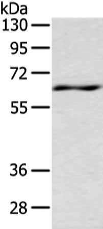 Gel: 8%SDS-PAGE, Lysate: 80 ug, Lane: Mouse spleen tissue, Primary antibody: CSB-PA117539(LZTS1 Antibody) at dilution 1/200 dilution, Secondary antibody: Goat anti rabbit IgG at 1/8000 dilution, Exposure time: 10 seconds