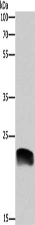Gel: 10%SDS-PAGE, Lysate: 40 ug, Lane: A549 cells, Primary antibody: CSB-PA118943(ADM Antibody) at dilution 1/600, Secondary antibody: Goat anti rabbit IgG at 1/8000 dilution, Exposure time: 2 minutes