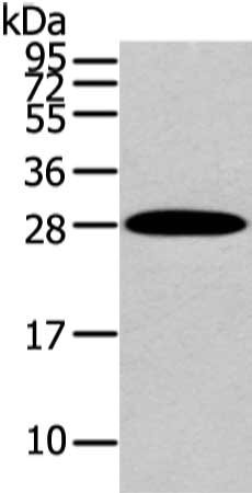 Gel: 12%SDS-PAGE, Lysate: 40 ug, Lane: Human liver cancer tissue, Primary antibody: CSB-PA123199(ZNF365 Antibody) at dilution 1/200 dilution, Secondary antibody: Goat anti rabbit IgG at 1/8000 dilution, Exposure time: 10 seconds