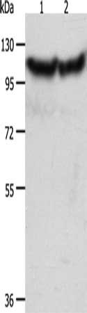 Gel: 10%SDS-PAGE, Lysate: 40 ug, Lane 1-2: Hela cells, NIH/3T3 cells, Primary antibody: CSB-PA124802(ACTN3 Antibody) at dilution 1/300, Secondary antibody: Goat anti rabbit IgG at 1/8000 dilution, Exposure time: 10 seconds
