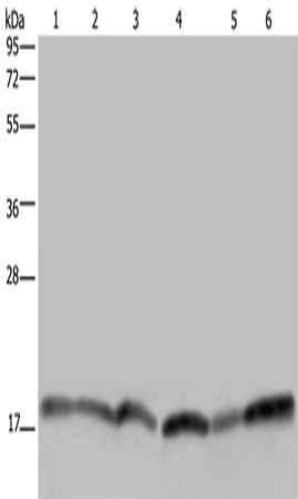 Gel: 10%SDS-PAGE, Lysate: 40 ug, Lane 1-6: Human brain malignant glioma tissue, Jurkat cells, Raji cells, 231 cells, human fetal brain tissue, Hela cells, Primary antibody: CSB-PA124825(RHEB Antibody) at dilution 1/300, Secondary antibody: Goat anti rabbit IgG at 1/8000 dilution, Exposure time: 5 seconds