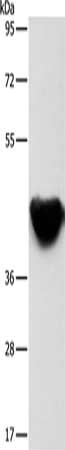 Gel: 8%SDS-PAGE, Lysate: 40 ug, Lane: Mouse heart tissue, Primary antibody: CSB-PA125050(ACTA2 Antibody) at dilution 1/500, Secondary antibody: Goat anti rabbit IgG at 1/8000 dilution, Exposure time: 1 minute