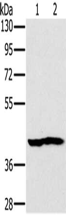 Gel: 8%SDS-PAGE, Lysate: 40 ug, Lane 1-2: Mouse heart tissue, Mouse kidney tissue, Primary antibody: CSB-PA127792(NDUFA10 Antibody) at dilution 1/450, Secondary antibody: Goat anti rabbit IgG at 1/8000 dilution, Exposure time: 40 seconds
