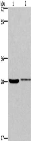 Gel: 8%SDS-PAGE, Lysate: 40 ug, Lane 1-2: 231 cells, Hela cells, Primary antibody: CSB-PA130000(CDK1 Antibody) at dilution 1/300, Secondary antibody: Goat anti rabbit IgG at 1/8000 dilution, Exposure time: 3 minutes