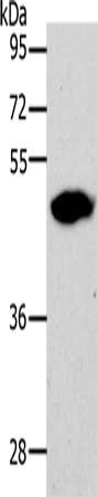 Gel: 10%SDS-PAGE, Lysate: 60 ug, Lane: 293T cells, Primary antibody: CSB-PA130669(LOX Antibody) at dilution 1/500, Secondary antibody: Goat anti rabbit IgG at 1/8000 dilution, Exposure time: 1 minute