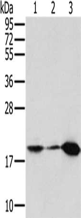 Gel: 10%SDS-PAGE, Lysate: 40 ug, Lane 1-3: Mouse kidney tissue, hela cells, mouse heart tissue, Primary antibody: CSB-PA132736(MTFP1 Antibody) at dilution 1/200, Secondary antibody: Goat anti rabbit IgG at 1/8000 dilution, Exposure time: 5 seconds