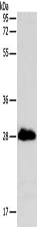 Gel: 12%SDS-PAGE, Lysate: 40 ug, Lane: Mouse heart tissue, Primary antibody: CSB-PA133116(TNNI3 Antibody) at dilution 1/175, Secondary antibody: Goat anti rabbit IgG at 1/8000 dilution, Exposure time: 10 seconds