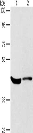 Gel: 8%SDS-PAGE, Lysate: 40 ug, Lane 1-2: Hela cells, mouse kidney tissue, Primary antibody: CSB-PA133169(KCNA7 Antibody) at dilution 1/550, Secondary antibody: Goat anti rabbit IgG at 1/8000 dilution, Exposure time: 40 seconds