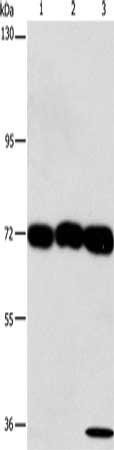 Gel: 6%SDS-PAGE, Lysate: 40 ug, Lane 1-3: 293T cells, hepG2 cells, A549 cells, Primary antibody: CSB-PA133590(CKAP4 Antibody) at dilution 1/1250, Secondary antibody: Goat anti rabbit IgG at 1/8000 dilution, Exposure time: 30 seconds