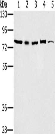 Gel: 6%SDS-PAGE, Lysate: 40 ug, Lane 1-5: 293T cells, Raw264.7 cells, NIH/3T3 cells, K562 cells, Jurkat cells, Primary antibody: CSB-PA133615(TAB3 Antibody) at dilution 1/800, Secondary antibody: Goat anti rabbit IgG at 1/8000 dilution, Exposure time: 10 seconds