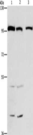 Gel: 6%SDS-PAGE, Lysate: 40 ug, Lane 1-3: HepG2 cells, 231 cells, hela cells, Primary antibody: CSB-PA135409(ANAPC4 Antibody) at dilution 1/300, Secondary antibody: Goat anti rabbit IgG at 1/8000 dilution, Exposure time: 1 minute