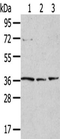 Gel: 8%SDS-PAGE,Lysate: 40 ug,Lane 1-3: 231 cells, 293T cells, Lovo cells,Primary antibody: CSB-PA137162(TPST1 Antibody) at dilution 1/200 dilution,Secondary antibody: Goat anti rabbit IgG at 1/8000 dilution,Exposure time: 2 minutes