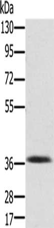 Gel: 8%SDS-PAGE, Lysate: 40 ug, Lane: Mouse liver tissue, Primary antibody: CSB-PA137424(PDLIM2 Antibody) at dilution 1/250, Secondary antibody: Goat anti rabbit IgG at 1/8000 dilution, Exposure time: 3 minutes