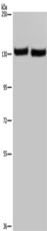 Gel: 6%SDS-PAGE, Lysate: 40 ug, Lane 1-2: A549 cells, human testis tissue, Primary antibody: CSB-PA137528(IPO4 Antibody) at dilution 1/550, Secondary antibody: Goat anti rabbit IgG at 1/8000 dilution, Exposure time: 40 seconds
