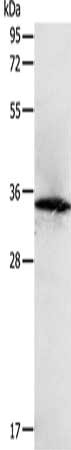 Gel: 12%SDS-PAGE, Lysate: 40 ug, Lane: MCF7 cells, Primary antibody: CSB-PA143745(SIRT4 Antibody) at dilution 1/400, Secondary antibody: Goat anti rabbit IgG at 1/8000 dilution, Exposure time: 1 minute