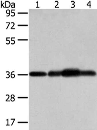 Gel: 8%SDS-PAGE, Lysate: 40 ug, Lane 1-4: Mouse brain tissue, hepg2, 293T and 231 cell, Primary antibody: CSB-PA144649(STX12 Antibody) at dilution 1/800 dilution, Secondary antibody: Goat anti rabbit IgG at 1/8000 dilution, Exposure time: 5 seconds