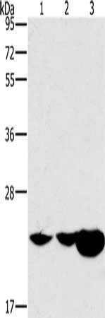Gel: 10%SDS-PAGE, Lysate: 40 ug, Lane 1-3: Mouse kidney tissue, Mouse liver tissue, human fetal liver tissue, Primary antibody: CSB-PA159201(HRASLS2 Antibody) at dilution 1/362.5, Secondary antibody: Goat anti rabbit IgG at 1/8000 dilution, Exposure time: 40 seconds