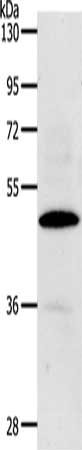 Gel: 10%SDS-PAGE, Lysate: 40 ug, Lane: Hela cells, Primary antibody: CSB-PA160889(CDC37 Antibody) at dilution 1/100, Secondary antibody: Goat anti rabbit IgG at 1/8000 dilution, Exposure time: 90 seconds