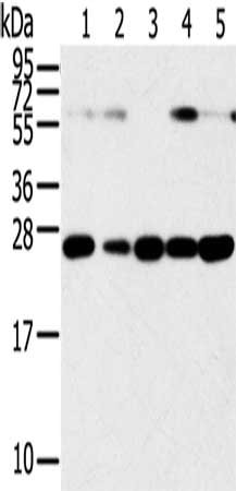 Gel: 12%SDS-PAGE, Lysate: 40 ug, Lane 1-6: Human placenta tissue, hela cells, hepg2 cells, human fetal liver tissue, A549 cells, human normal kidney tissue, Primary antibody: CSB-PA161006(SNAP23 Antibody) at dilution 1/400, Secondary antibody: Goat anti rabbit IgG at 1/8000 dilution, Exposure time: 15 seconds