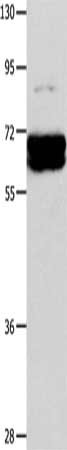 Gel: 10%SDS-PAGE, Lysate: 40 ug, Lane: Mouse brain tissue, Primary antibody: CSB-PA161781(CRMP1 Antibody) at dilution 1/350, Secondary antibody: Goat anti rabbit IgG at 1/8000 dilution, Exposure time: 2 seconds