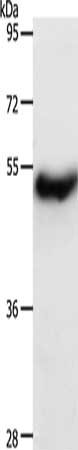 Gel: 10%SDS-PAGE, Lysate: 40 ug, Lane: Human liver cancer tissue, Primary antibody: CSB-PA169146(CERS2 Antibody) at dilution 1/1000, Secondary antibody: Goat anti rabbit IgG at 1/8000 dilution, Exposure time: 40 seconds
