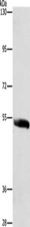 Gel: 6%SDS-PAGE, Lysate: 40 ug, Lane: Human prostate tissue, Primary antibody: CSB-PA175505(SYT17 Antibody) at dilution 1/450, Secondary antibody: Goat anti rabbit IgG at 1/8000 dilution, Exposure time: 40 seconds