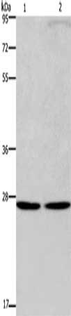 Gel: 8%SDS-PAGE, Lysate: 40 ug, Lane 1-2: A375 cells, Hela cells, Primary antibody: CSB-PA183025(EIF6 Antibody) at dilution 1/200, Secondary antibody: Goat anti rabbit IgG at 1/8000 dilution, Exposure time: 10 minutes Gel: 8%SDS-PAGE, Lysate: 40 ug, Lane 1-2: A375 cells, Hela cells, Primary antibody: CSB-PA183025(EIF6 Antibody) at dilution 1/200, Secondary antibody: Goat anti rabbit IgG at 1/8000 dilution, Exposure time: 10 minutes