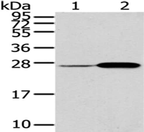 Western Blotting(WB) - CD79A Antibody