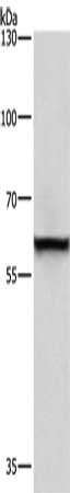 Gel: 6%SDS-PAGE, Lysate: 40 ug, Lane: A431 cells, Primary antibody: CSB-PA193346(TRIP4 Antibody) at dilution 1/400, Secondary antibody: Goat anti rabbit IgG at 1/8000 dilution, Exposure time: 10 seconds