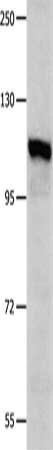 Gel: 8%SDS-PAGE, Lysate: 40 ug, Lane: K562 cells, Primary antibody: CSB-PA194156(IDE Antibody) at dilution 1/350, Secondary antibody: Goat anti rabbit IgG at 1/8000 dilution, Exposure time: 40 seconds