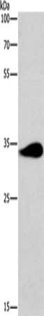 Gel: 8%SDS-PAGE, Lysate: 40 ug, Lane: Mouse brain tissue, Primary antibody: CSB-PA197029(TNIP3 Antibody) at dilution 1/200, Secondary antibody: Goat anti rabbit IgG at 1/8000 dilution, Exposure time: 1 minute Gel: 8%SDS-PAGE, Lysate: 40 ug, Lane: Mouse brain tissue, Primary antibody: CSB-PA197029(TNIP3 Antibody) at dilution 1/200, Secondary antibody: Goat anti rabbit IgG at 1/8000 dilution, Exposure time: 1 minute