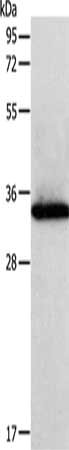 Gel: 12%SDS-PAGE, Lysate: 40 microg, Lane: MCF-7 cells, Primary antibody: CSB-PA201090(SIRT4 Antibody) at dilution 1/450, Secondary antibody: Goat anti rabbit IgG at 1/8000 dilution, Exposure time: 1 minute