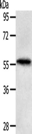 Gel: 10%SDS-PAGE, Lysate: 40 ug, Lane: Human fetal liver tissue, Primary antibody: CSB-PA202607(MATN4 Antibody) at dilution 1/200, Secondary antibody: Goat anti rabbit IgG at 1/8000 dilution, Exposure time: 30 seconds Gel: 10%SDS-PAGE, Lysate: 40 ug, Lane: Human fetal liver tissue, Primary antibody: CSB-PA202607(MATN4 Antibody) at dilution 1/200, Secondary antibody: Goat anti rabbit IgG at 1/8000 dilution, Exposure time: 30 seconds