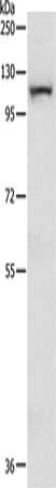 Gel: 8%SDS-PAGE, Lysate: 40 ug, Lane: Mouse lung tissue, Primary antibody: CSB-PA206897(MAP3K14 Antibody) at dilution 1/200, Secondary antibody: Goat anti rabbit IgG at 1/8000 dilution, Exposure time: 10 minutes