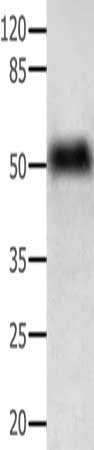 Western Blotting(WB) - ACTG1 Antibody