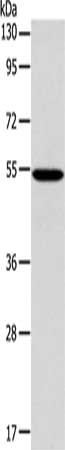 Gel: 10%SDS-PAGE, Lysate: 40 ug, Lane: 293T cells, Primary antibody: CSB-PA233398(ERG Antibody) at dilution 1/650, Secondary antibody: Goat anti rabbit IgG at 1/8000 dilution, Exposure time: 2 minutes
